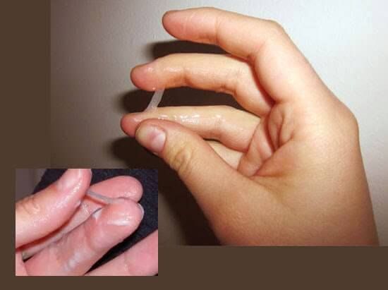 asam lambung ibu hamil