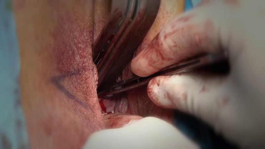 vagina close up