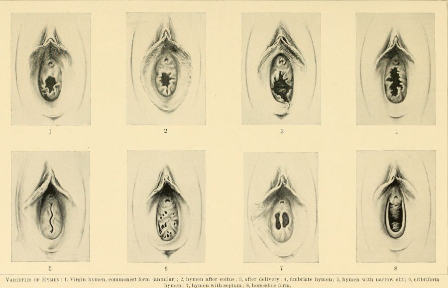 vagina perawan