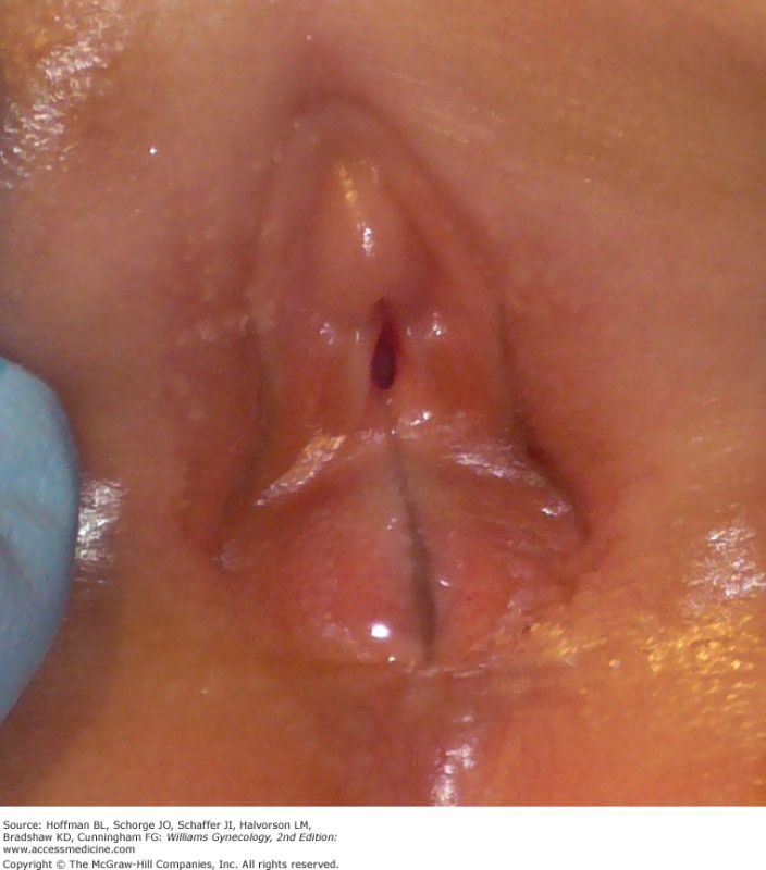 jessica simpson vagina