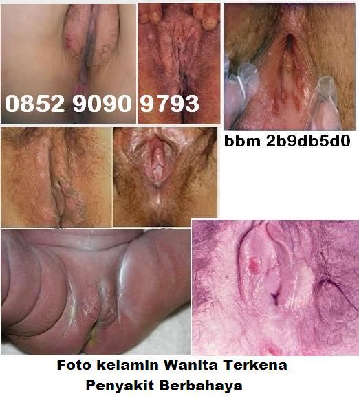 gambar vagina perawan