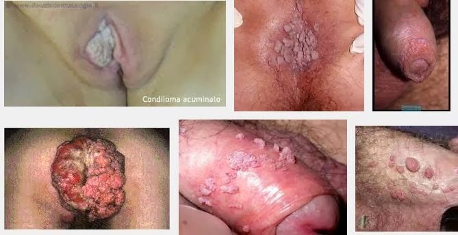 vagina yang sehat