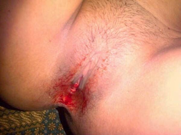gambar memek gede