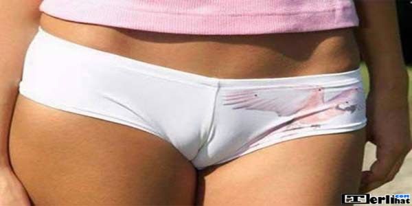 bentuk vagina perawan