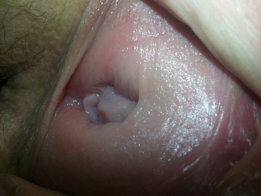 woman vagina
