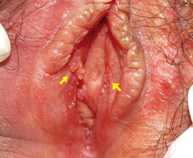 ejaculating into vagina