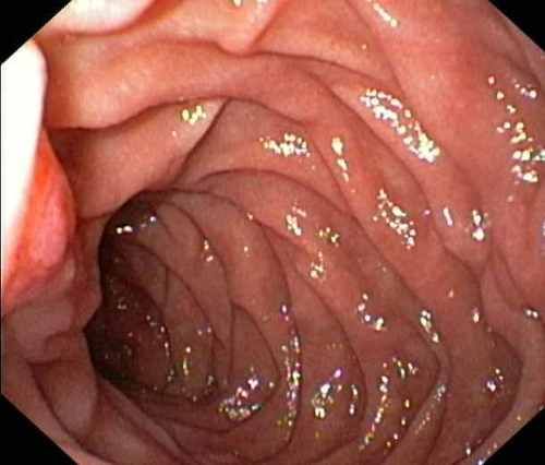 inside a girls vagina