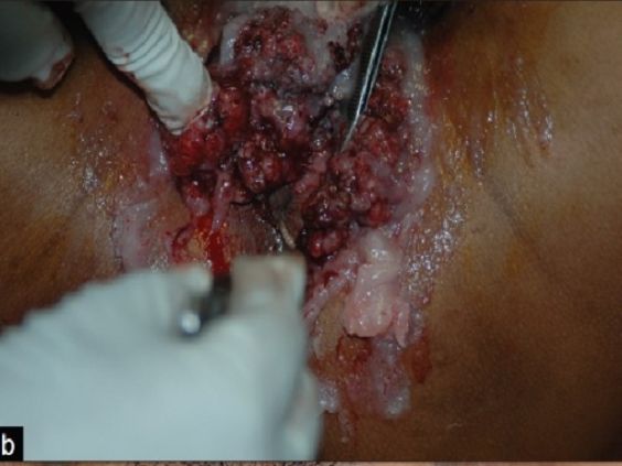 look inside a vagina