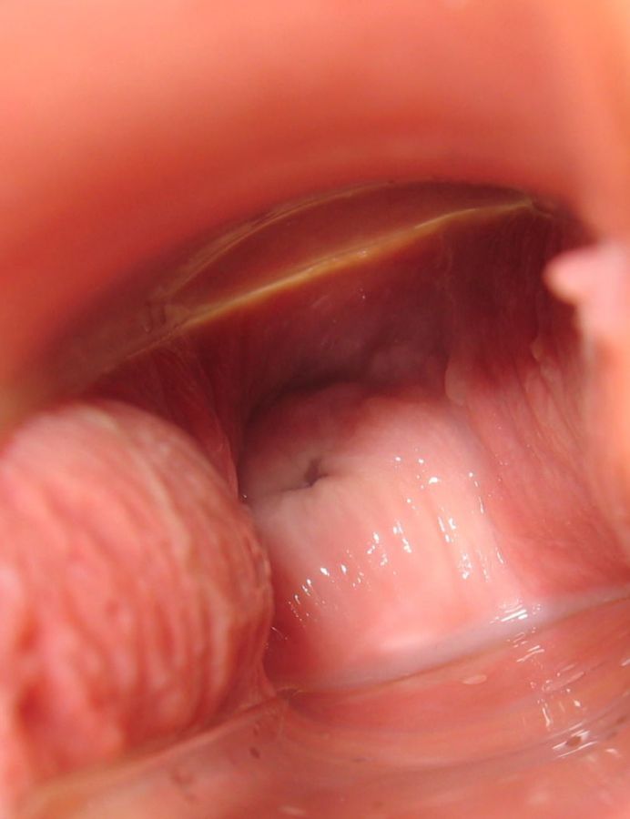 camera inside vagina