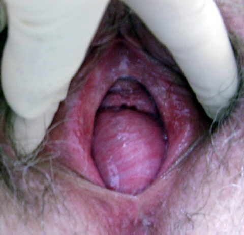 penis inside vagina