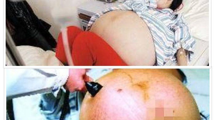vagina wanita hamil