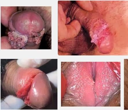 vagina orang hamil