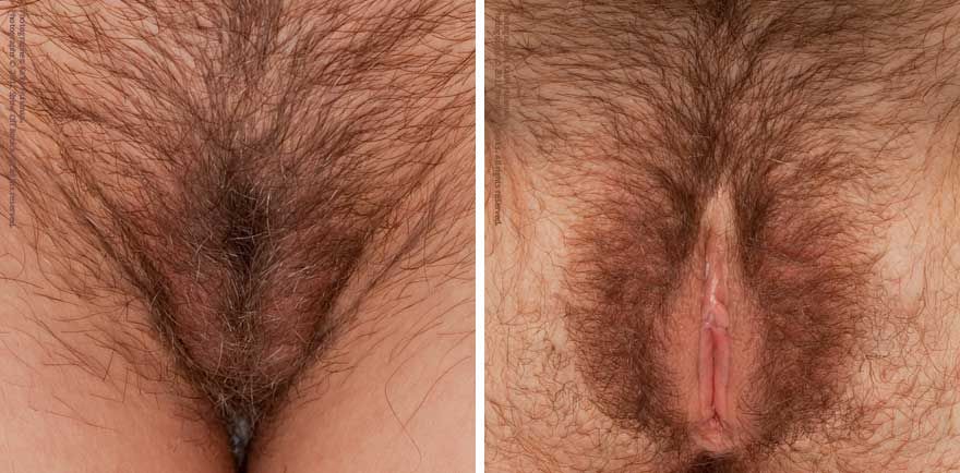 bentuk vagina yang indah