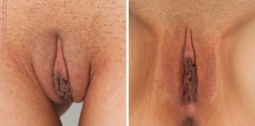 jenis vagina