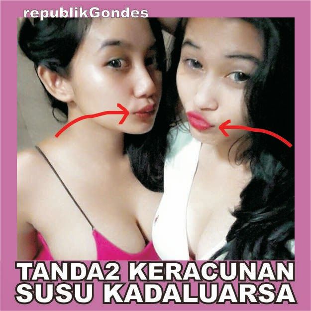 susu abg