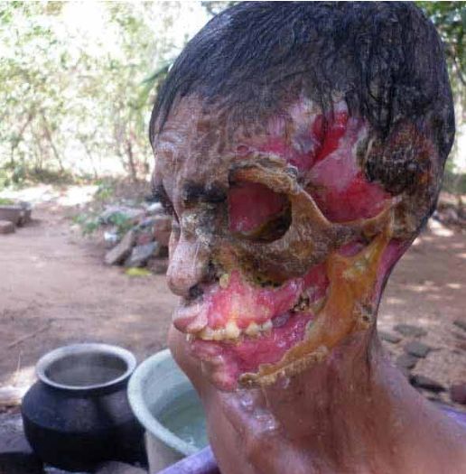 gambar kemaluan lelaki paling besar