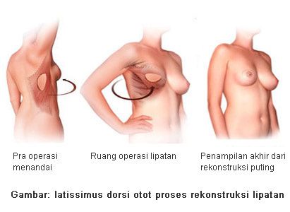 gambar kartun