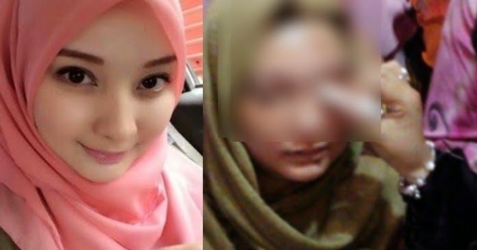 foto itil abg