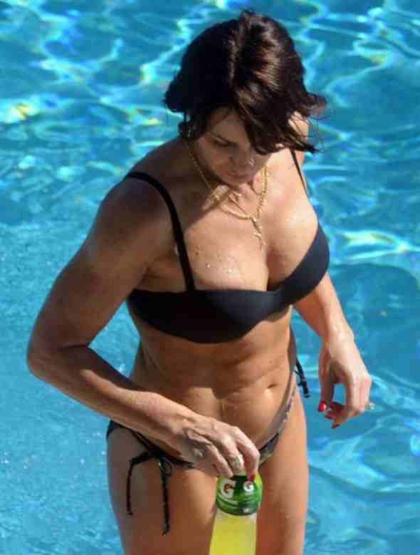 nadia comaneci implants