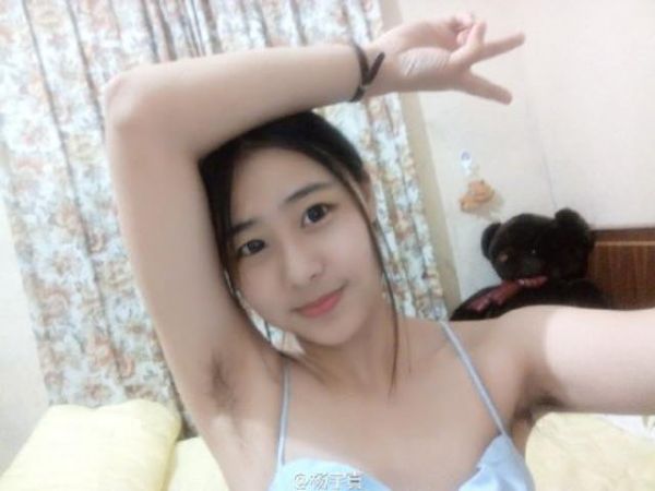 bulu lebat perempuan