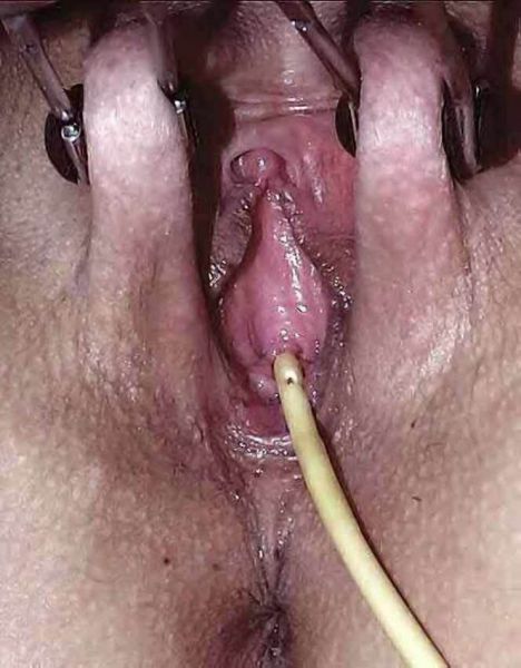 kontol berdiri