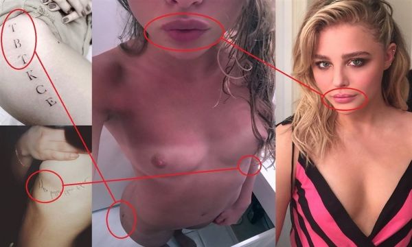chloe grace moretz surgery