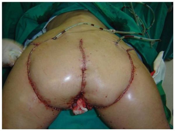 bokep toge indonesia