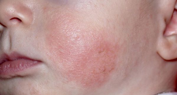bocyl